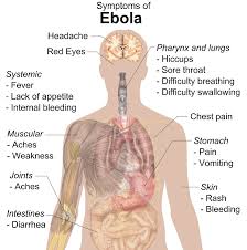 GHS Debunks Ebola Outbreak in Ghana