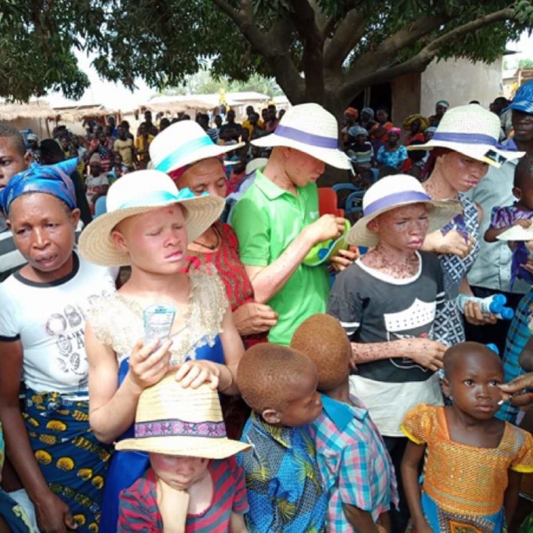 ENA Advocates for Rights of Persons with Albinism at Nabu